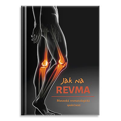 Jak na revma